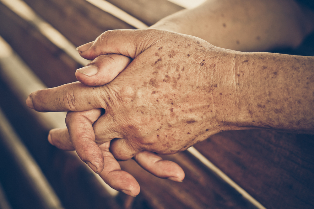 Younger Looking Hands