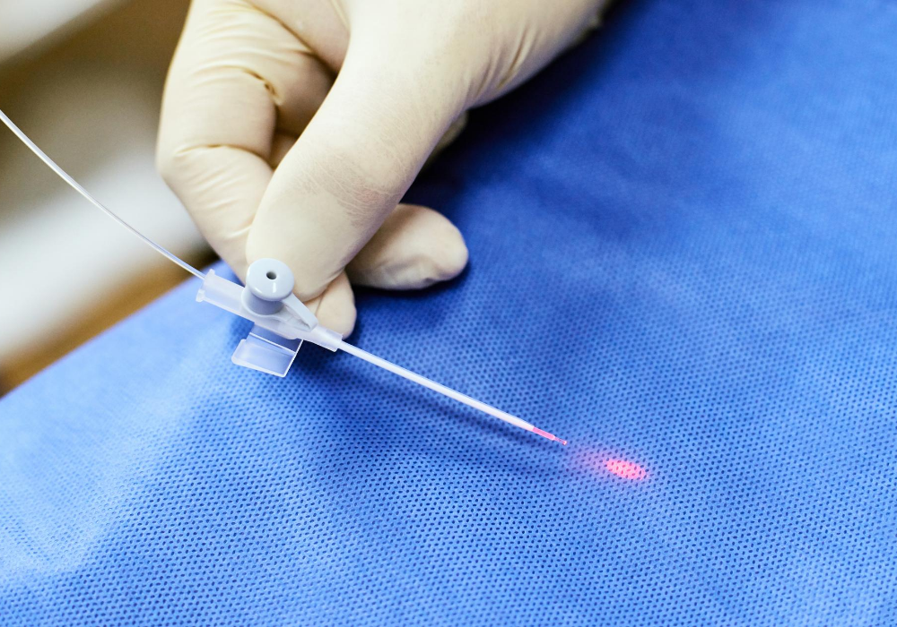 laser vein treatments columbia