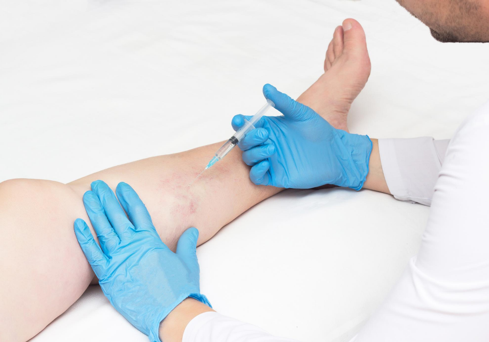 minimally invasive vein treatments in maryland