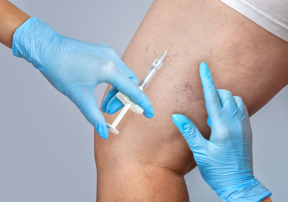 vein treatment specialist maryland