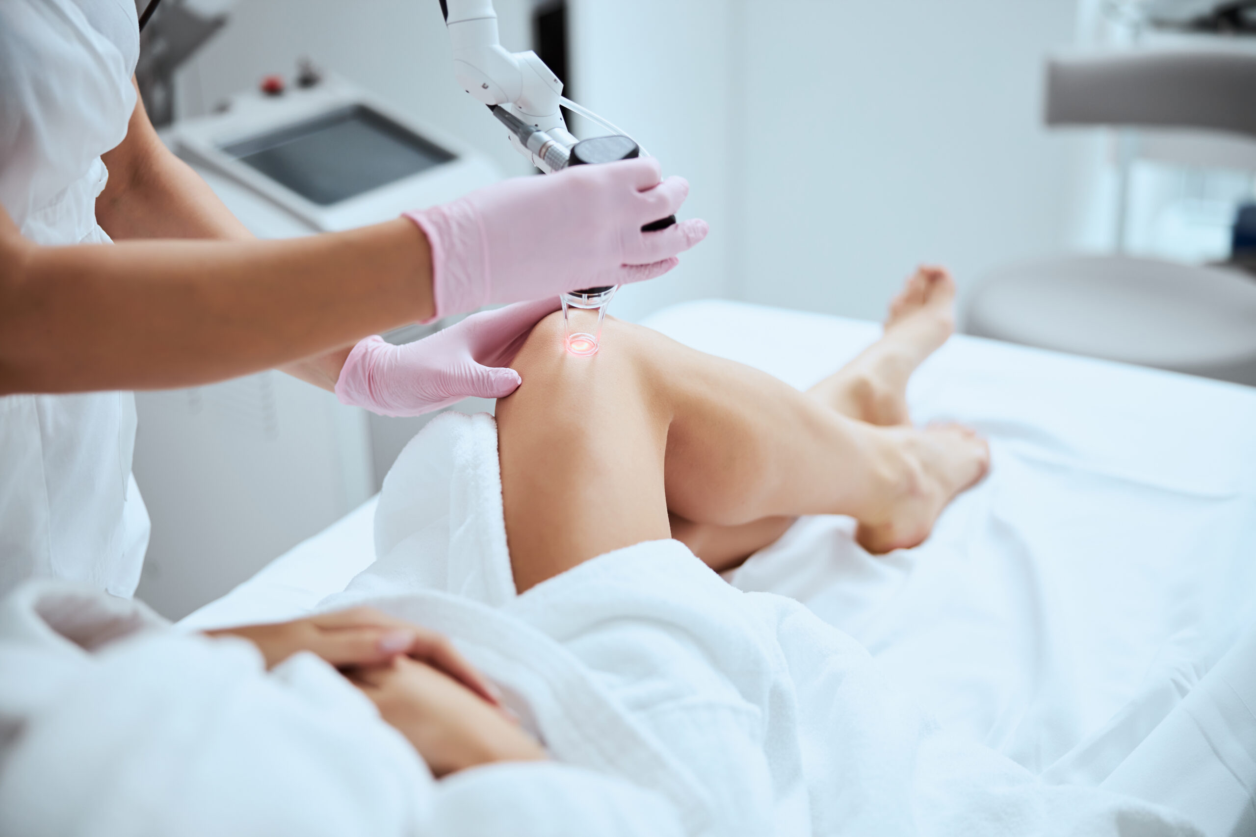 Laser Vein Treatment Columbia