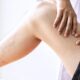 Sclerotherapy Montgomery County