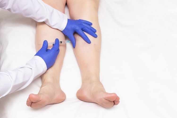 sclerotherapy specialist bel air md