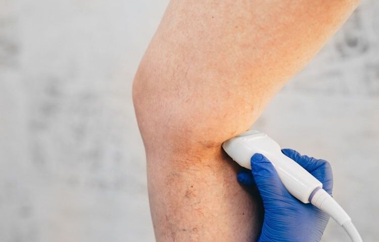 phlebitis specialist owings mills