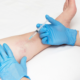 cost of sclerotherapy in Maryland