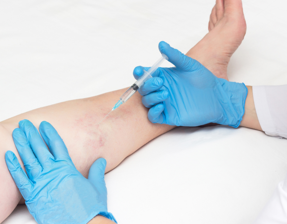 cost of sclerotherapy in Maryland