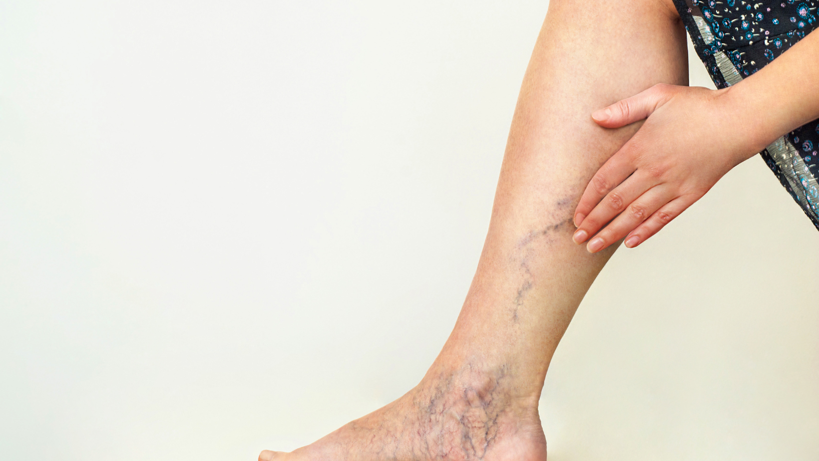 Minimally Invasive Vein Treatment in Maryland