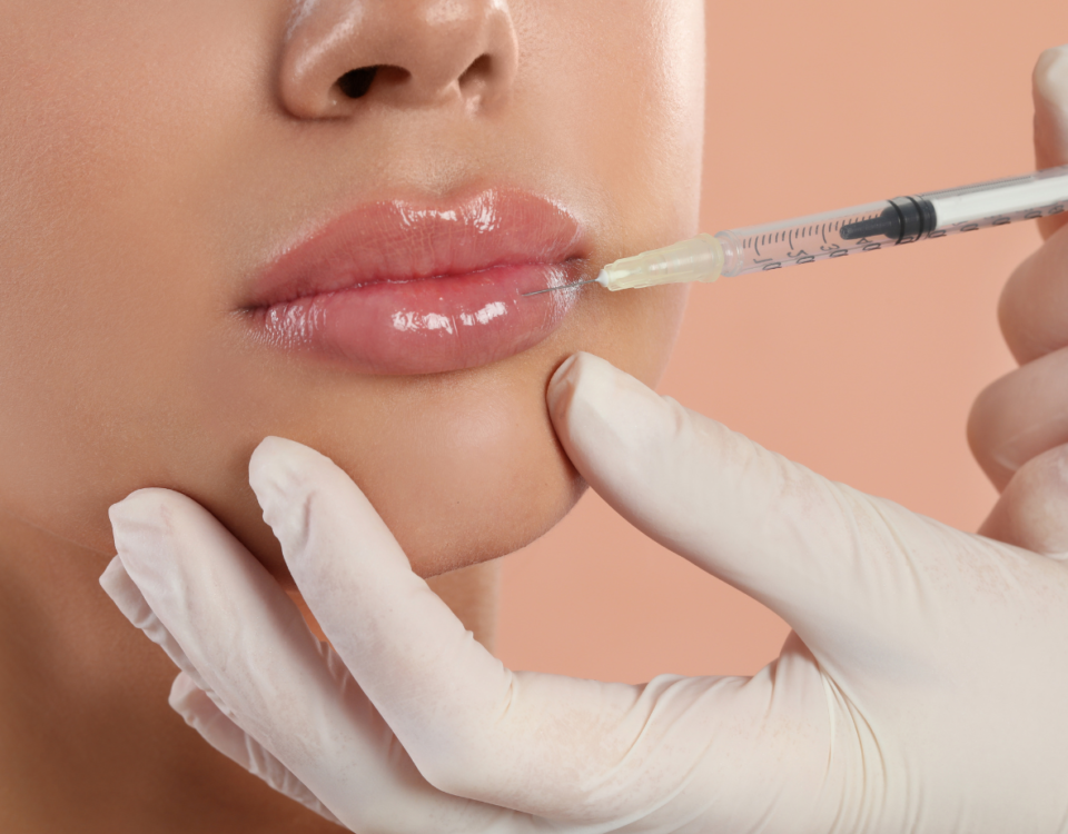 Guide to Lip Filler Maryland