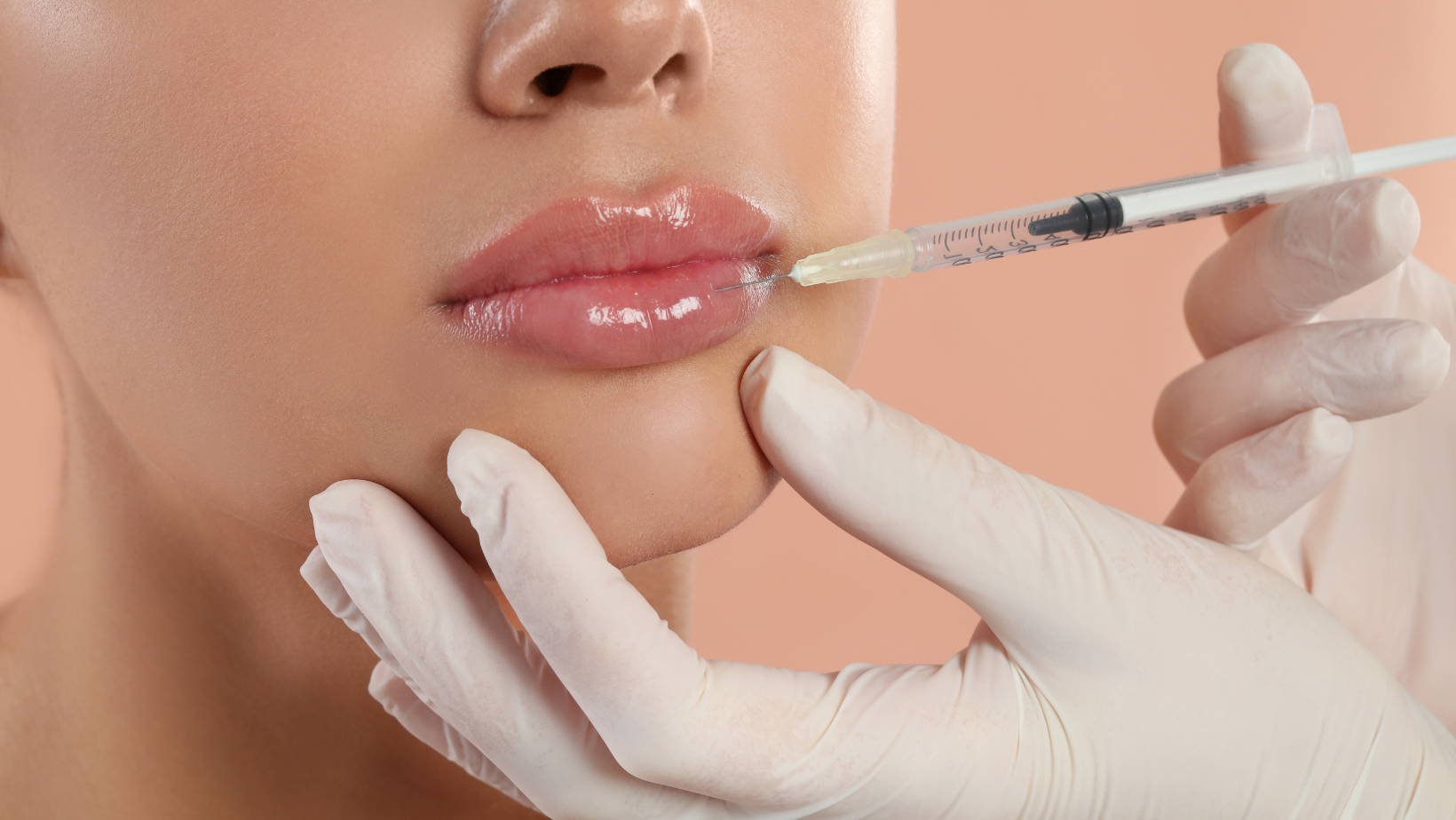 Guide to Lip Filler Maryland