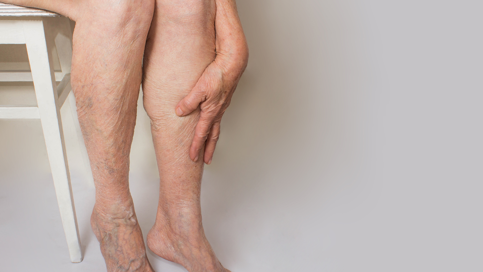 Are My Swollen Legs Caused by Varicose Veins