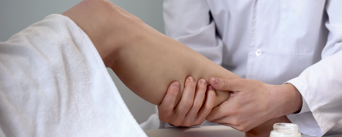 Does Insurance Cover Laser Vein Treatment