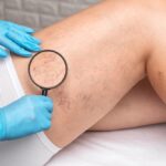 7 Signs to See a Vein Pain Specialist Near Aberdeen 