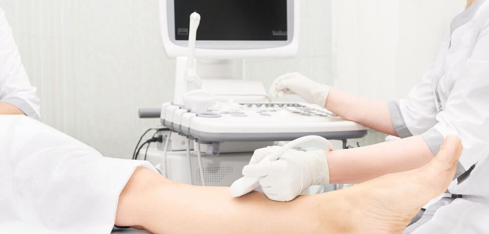 What to Expect During Your Free Vein Consultation in Owings Mills