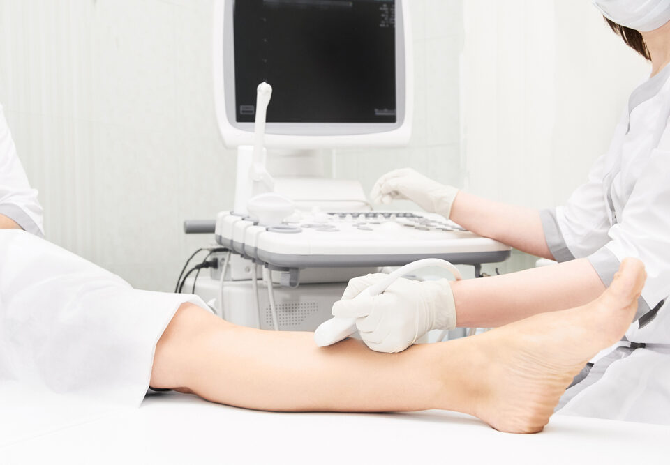 What to Expect During Your Free Vein Consultation in Owings Mills