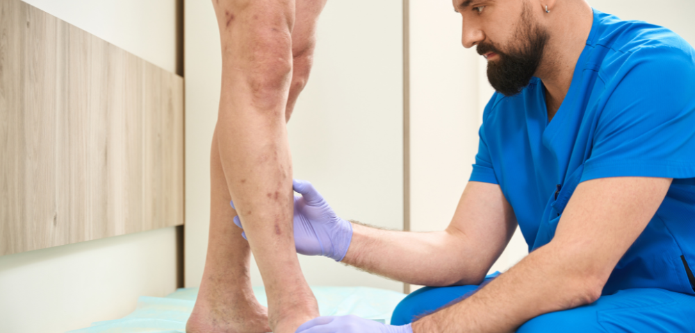 Visit with a Varicose Vein Doctor in Aberdeen MD