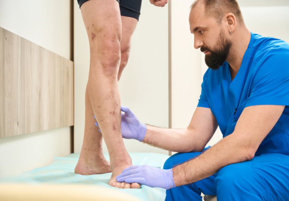 Visit with a Varicose Vein Doctor in Aberdeen MD