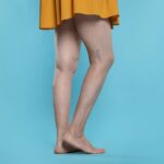 How Can I Book a Same-Day Leg Vein Consultation in Owings Mills, Maryland?