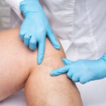 What You Should Know About Comprehensive Varicose Vein Treatments From the Best Doctors in Carroll County, MD and Surrounding Areas