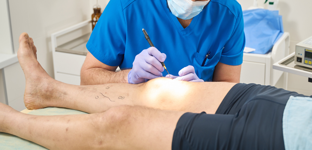 best leg vein specialist Mt. Airy