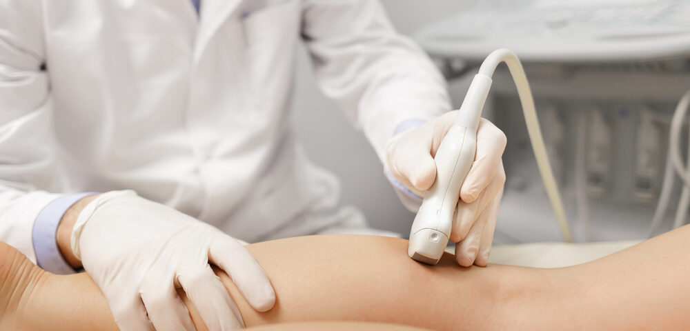 same-day vein consultation appointment in Havre de Grace MD