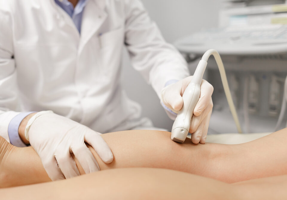 same-day vein consultation appointment in Havre de Grace MD