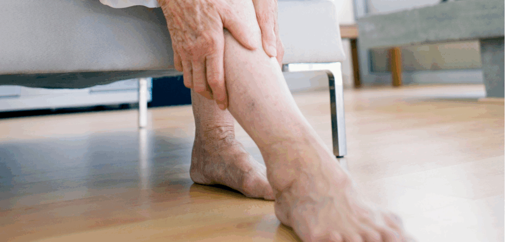 woman suffering from symptoms of varicose veins harford county