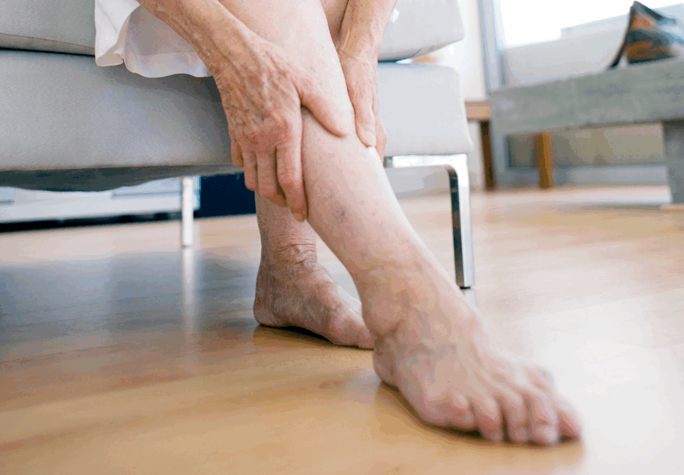 woman suffering from symptoms of varicose veins harford county