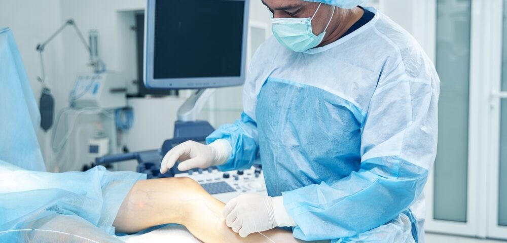 minimally invasive varicose vein treatments near Fallston MD