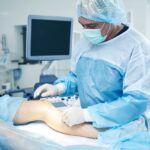 minimally invasive varicose vein treatments near Fallston MD