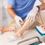 Free Vein Consultation Near Baltimore for Bulging Veins