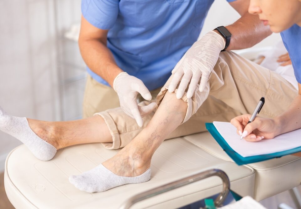 Free Vein Consultation Near Baltimore for Bulging Veins