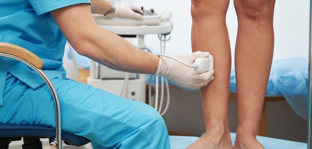 top-rated vein clinic Baltimore