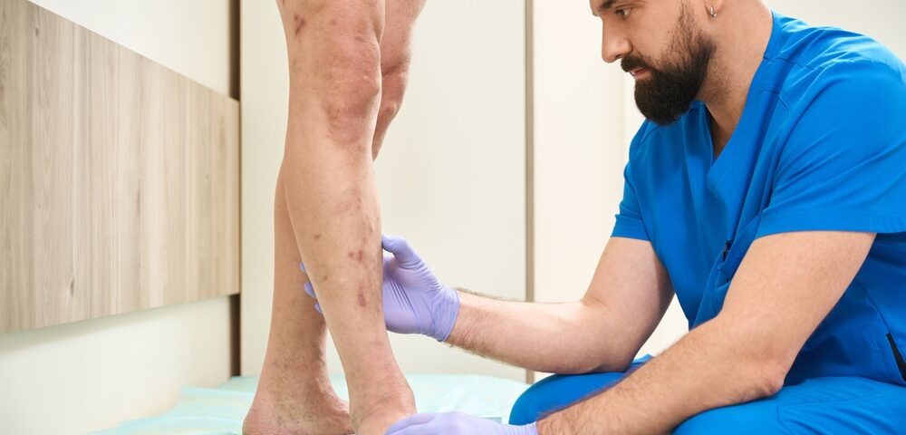 comprehensive vein disease consultation in Cockeysville MD