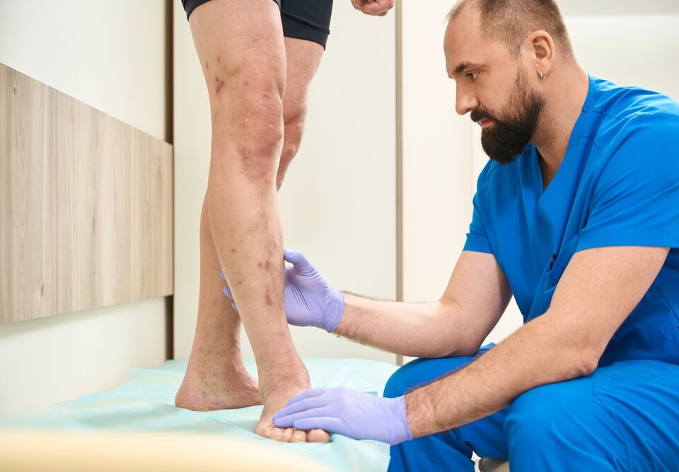 comprehensive vein disease consultation in Cockeysville MD