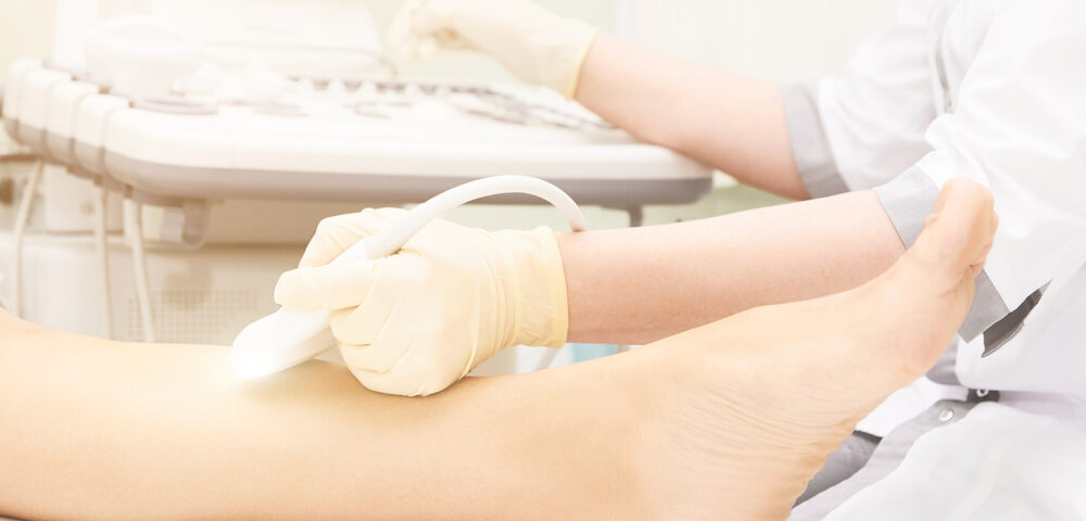 Same-Day Varicose Vein Evaluation in Bel Air