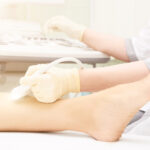 Same-Day Varicose Vein Evaluation in Bel Air