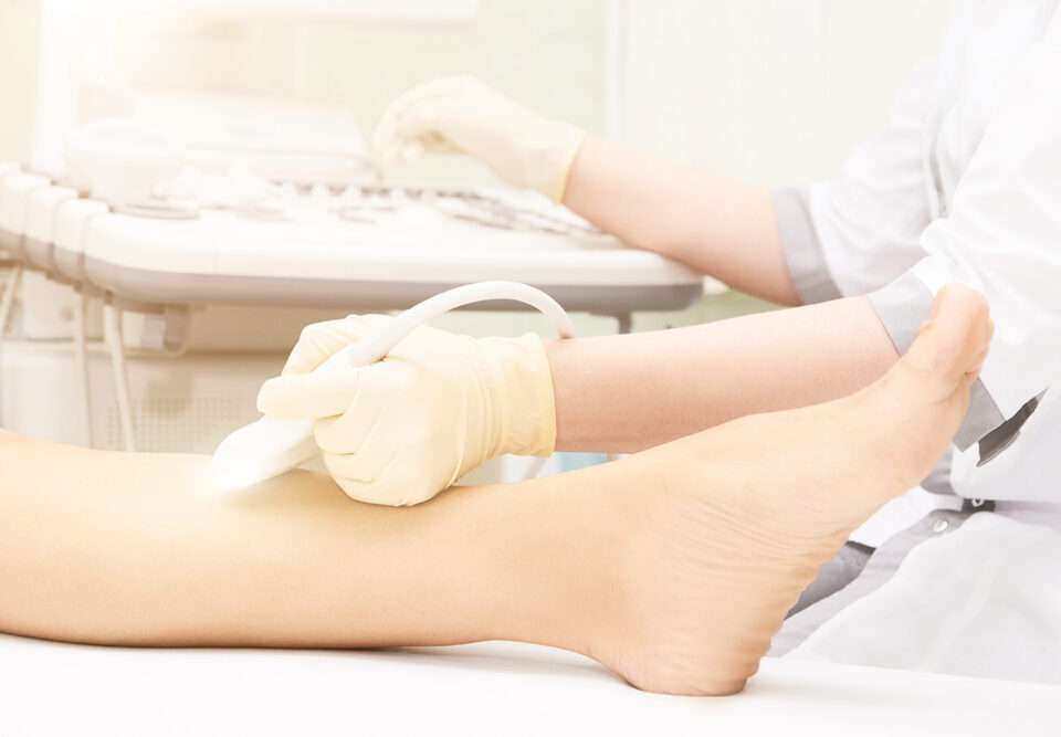 Same-Day Varicose Vein Evaluation in Bel Air
