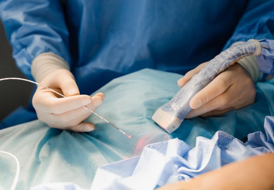 ultrasound-guided foam sclerotherapy in bel Air Maryland