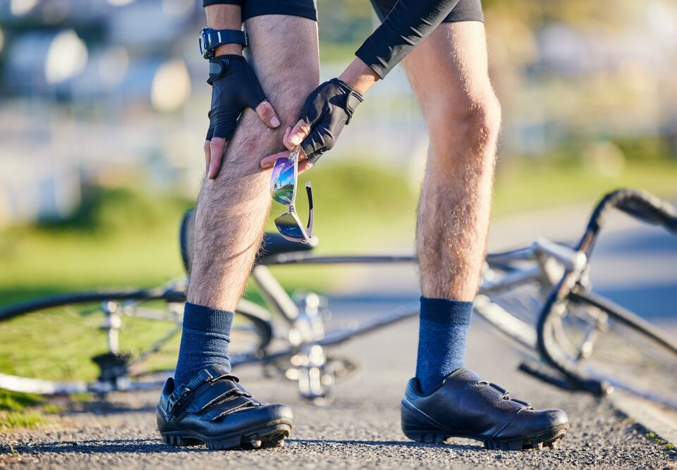 man with varicose veins affecting his day to day activty