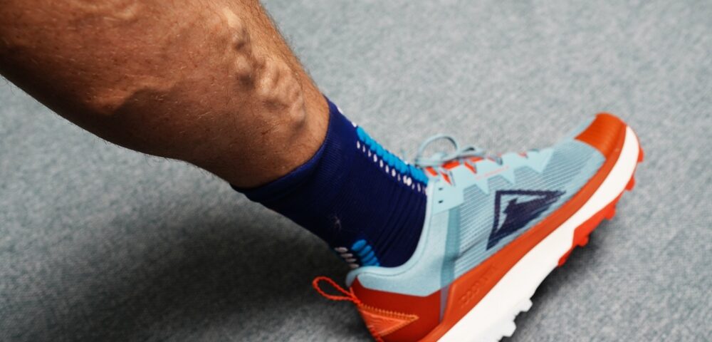 man in need of an Ambulatory Phlebectomy in Maryland