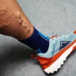 man in need of an Ambulatory Phlebectomy in Maryland