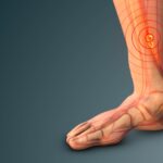 Deep Vein Thrombosis Harford County