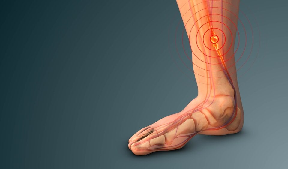 Deep Vein Thrombosis Harford County