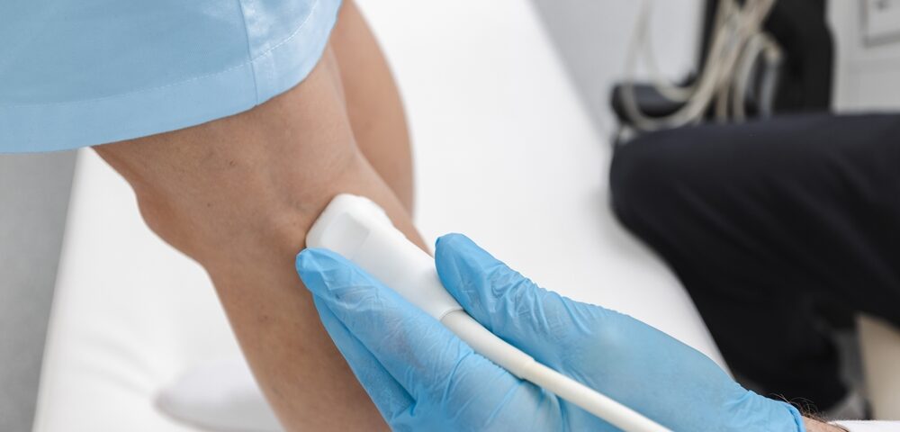 venous ultrasound Bel Air MD