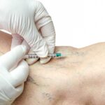 best sclerotherapy near me in Harford County