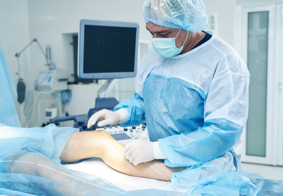 remove varicose veins in Maryland