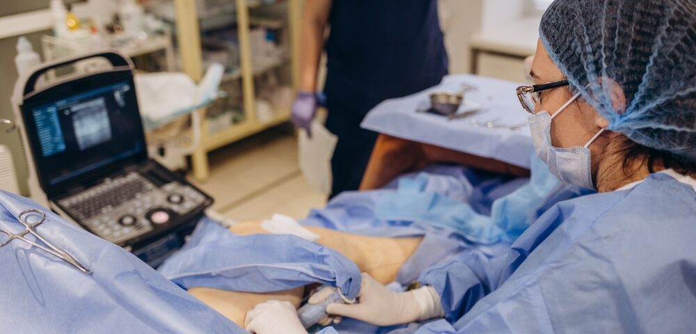 varicose vein treatments in Maryland