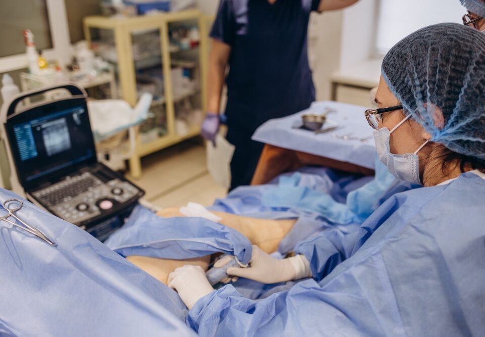 varicose vein treatments in Maryland