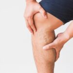 man after vein treatment with blood clots