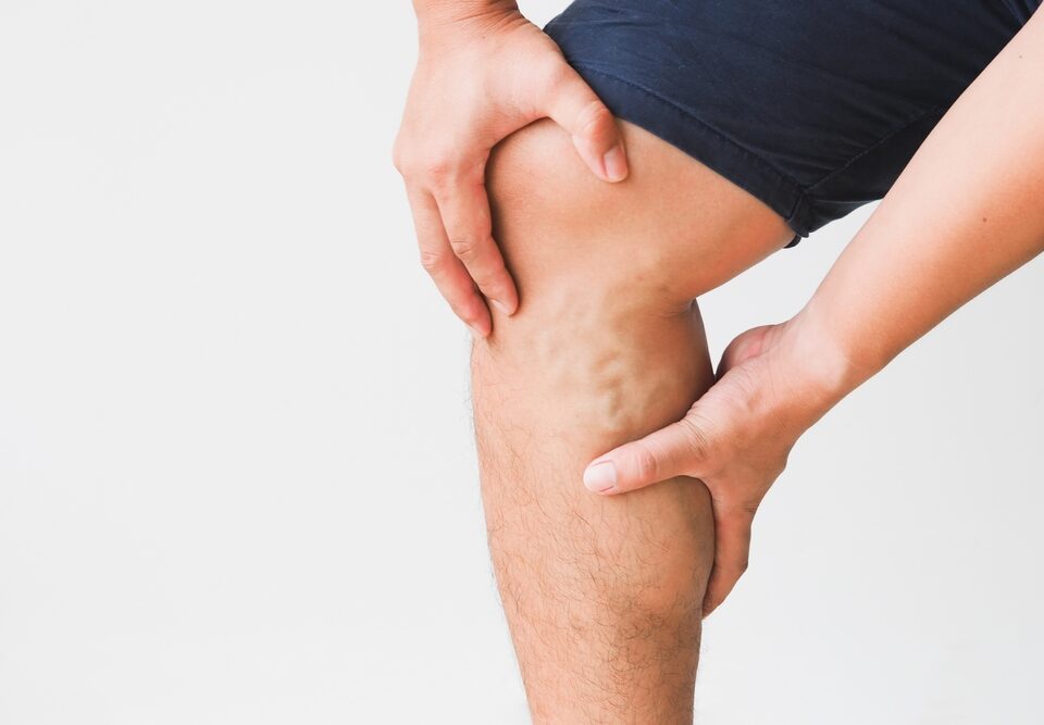man after vein treatment with blood clots